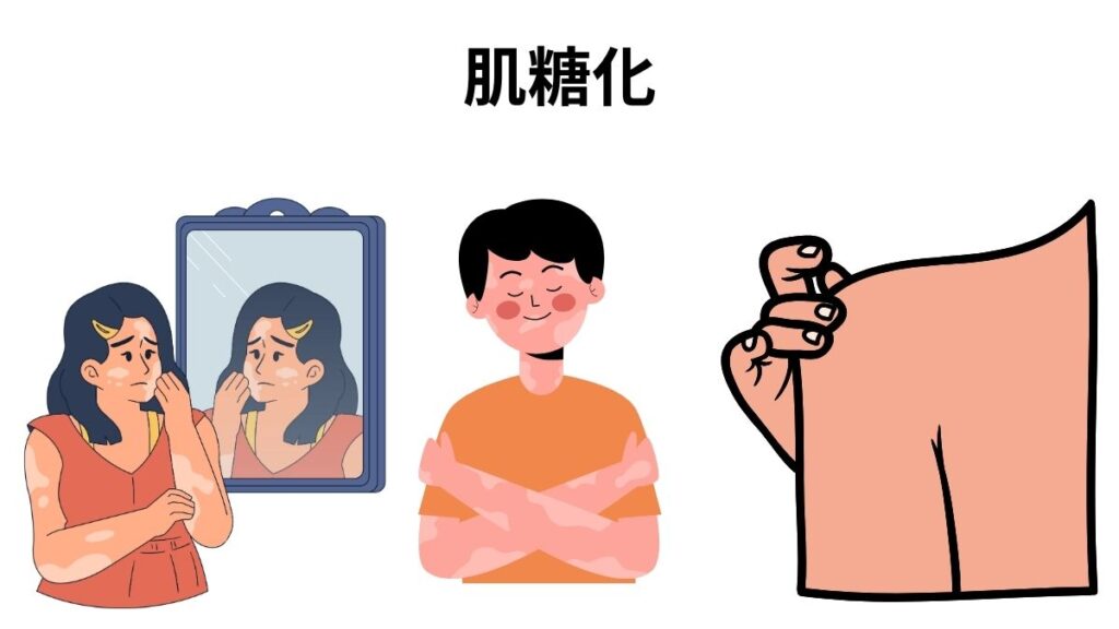 肌糖化